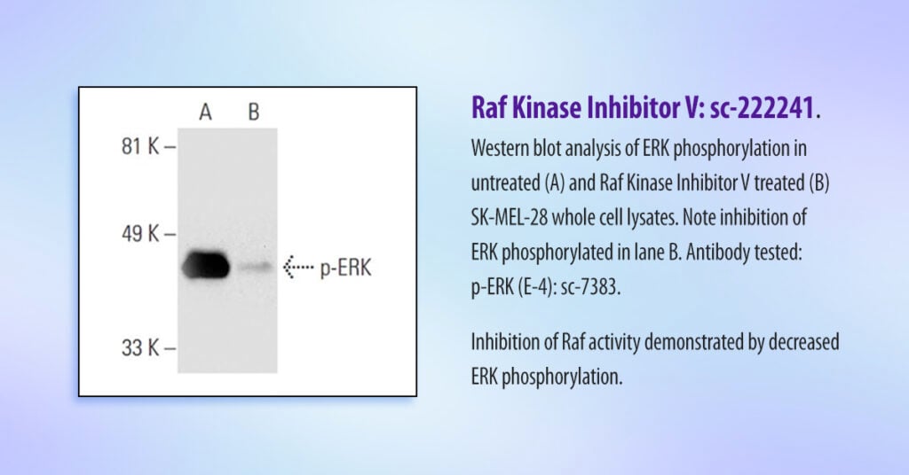 Data Raf Kinase sc 222241RGB 2