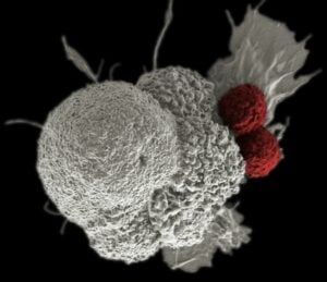 CAR T cell therapy companies