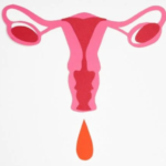 endometriosis top companies