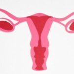 endometriosis awareness month 1