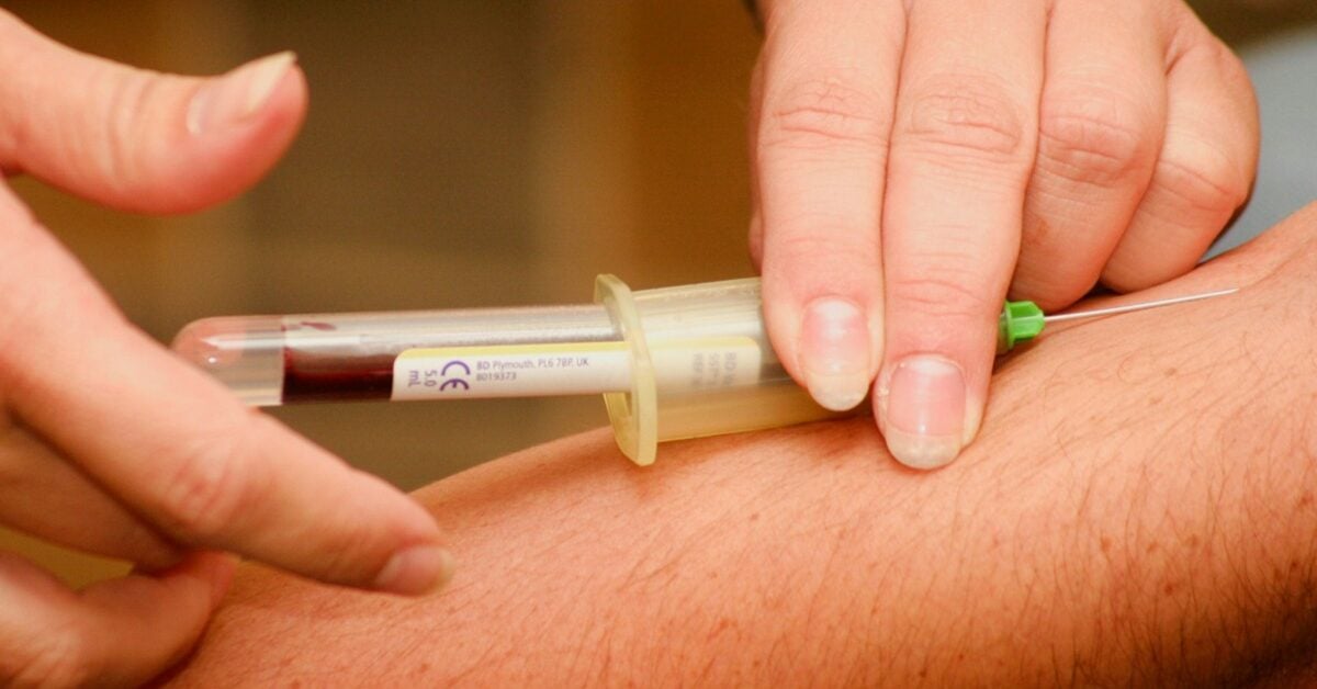 sickle cell disease treatment