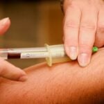 sickle cell disease treatment