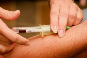 sickle cell disease treatment