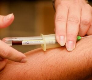 sickle cell disease treatment