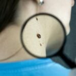 Melanoma vaccines