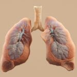 Lung scarring