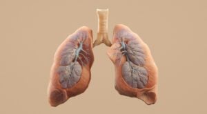 Lung scarring