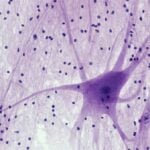Is AKIGAI's EGFR inhibitor the next big thing in neuropathic pain