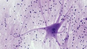 Is AKIGAI's EGFR inhibitor the next big thing in neuropathic pain