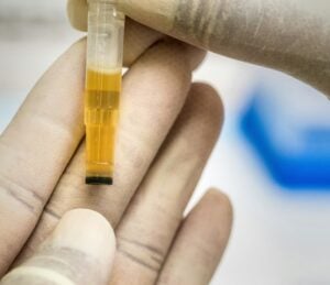 urinary tract infection diagnostics